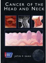 American Cancer Society Atlas of Clinical Oncology: Cancer of the Head and Neck (Book with CD-ROM)