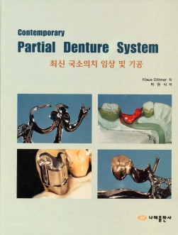 Contemporary Partial Denture System: 최신국소의치임상 및 기공