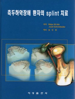 측두하악장애 환자의 splint 치료