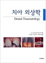 치아 외상학