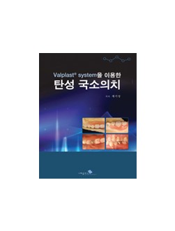 Valplast system을 이용한 탄성 국소의치