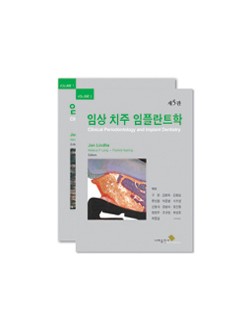 임상 치주 임플란트학 제5판 (Vol.1, 2) 전 2권