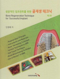 성공적인 임프란트를 위한 골재생 테크닉- 제2편