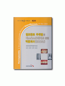 임프란트 주위염과 비스포스포네이트 관련 악골괴사(아! 이(齒)를 어쩌나) 제2편