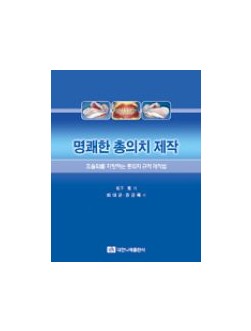 명쾌한 총의치 제작