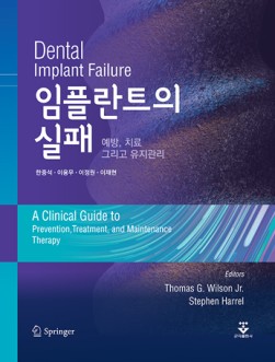 임플란트의 실패