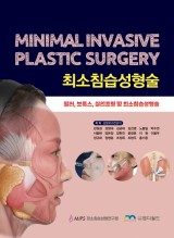 최소침습성형술(Minimal Invasive Plastic Surgery)