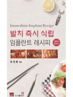 발치 즉시 식립 임플란트 레시피(이론에서 실전까지) Immediate Implant Recipe