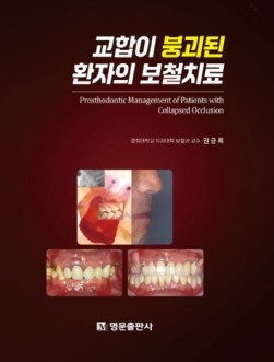 교합이 붕괴된 환자의 보철치료