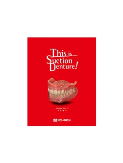 This is Suction Denture! 