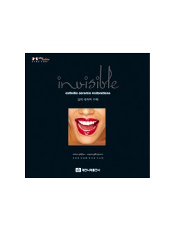 invisible esthetic ceramic restorations / 심미 세라믹 수복 