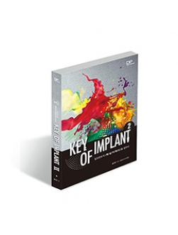 Key of Implant 2 - 임프란트의 핵심 키워드를 말하다