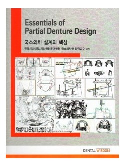 국소의치 설계의 핵심 Essentials of Partial Denture Design