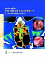 Endoscopic Sinus Surgery [Hardcover] 