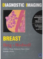 Diagnostic Imaging: Breast (IE)