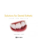 Solutions for Dental Esthetic 