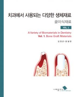 치과에서 사용되는 다양한 생체재료 골이식재료 VOL.1