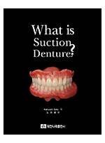 What is suction denture