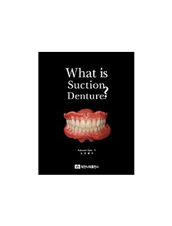 What is suction denture