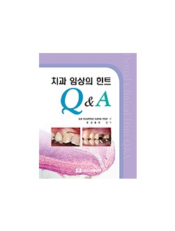 치과 임상의 힌트 Q&A 