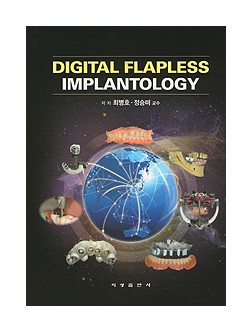 DIGITAL FLAPLESS IMPLANTOLOGY
