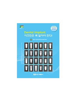 (Implant 임상지침서) Dental Implant 이것만은 꼭 알아야 한다! 