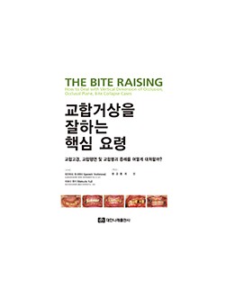 교합거상을 잘하는 핵심 요령 