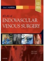 Atlas of Endovascular Venous Surgery, 2/e