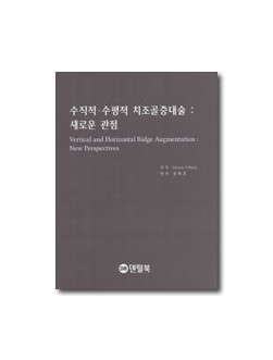 수직적수평적 치조골증대술