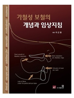 가철성 보철의 개념과 임상지침 - Clinical Concepts and Guidelines for Removable Prosthodontic Treatment