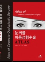 눈꺼풀 미용성형수술 ATLAS