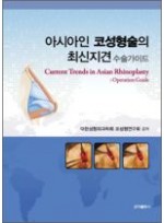 아시아인 코성형술의 최신지견 수술가이드