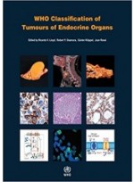 WHO Classification of Tumours of Endocrine Organs, 4/e