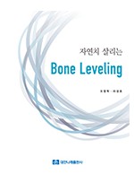 자연치 살리는 Bone Leveling  