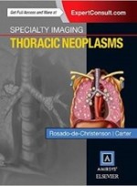 Specialty Imaging: Thoracic Neoplasms, 1e