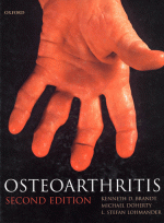 Osteoarthritis 2th