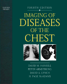 lmaging of Diseases of the Chest 4th