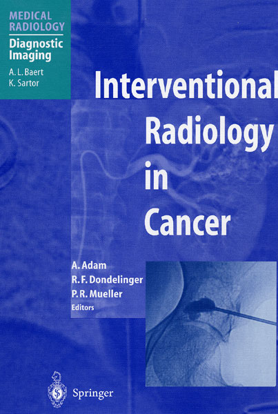 Interventional Radiology in Cancer