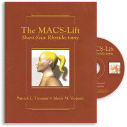 The MACS-Lift : Short Scar Rhytidectomy