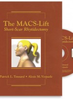 The MACS-Lift : Short Scar Rhytidectomy