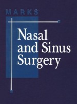 Nasal and Sinus Surgery