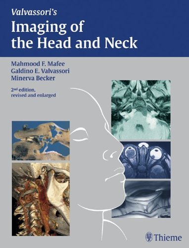 Imaging of the Head and Neck, 2e