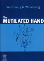 The Mutilated Hand
