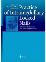 Practice of Intramedullary Locked Nails: Advanced Techniques and Special Applications