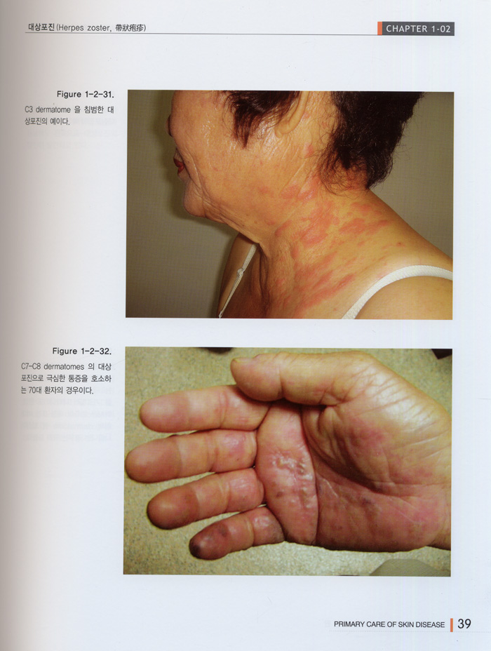 피부질환의 일차진료 제1권 (개정판)