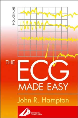 The Ecg Made Easy