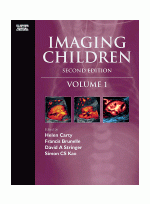 Imaging Children 2/e