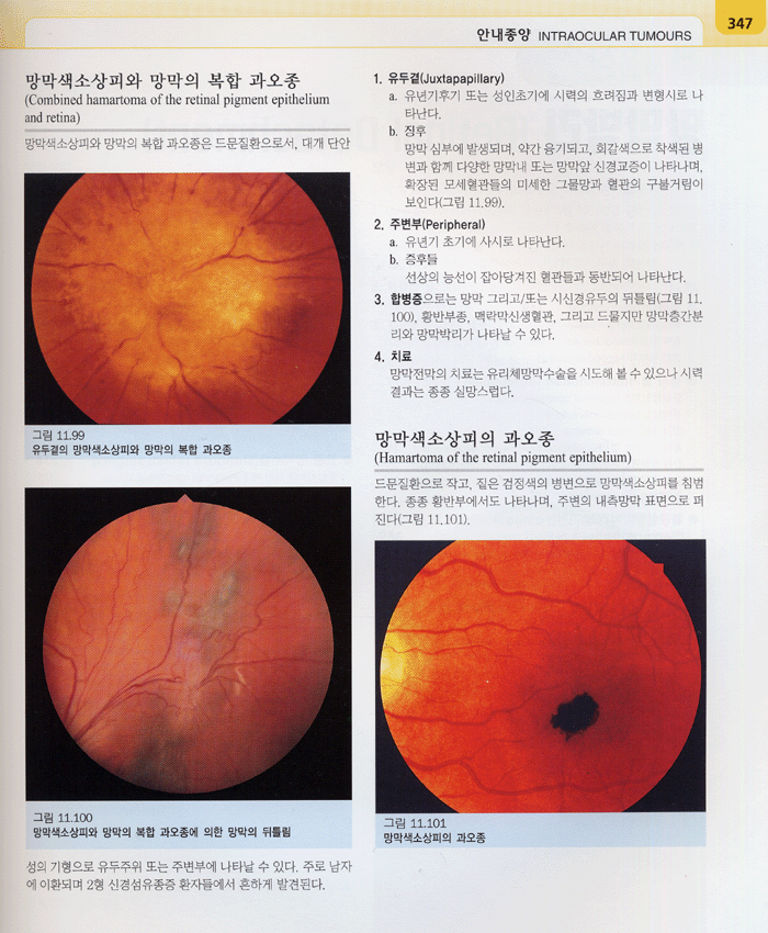 임상안과학 Clinical Ophthalmology 5th 번역서