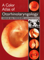 A Color Atlas of Otorhinolaryngology - 사진으로 보는 이비인후과학