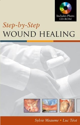Step By Step Wound Healing with CD